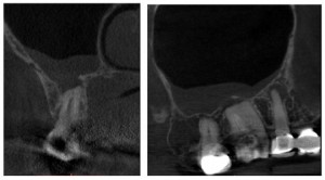 Conebeam CT and Sinus – CDI – Canadian Digital Imaging